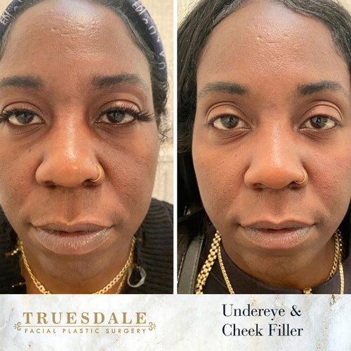 Truesdale Facial Plastic Surgery Before and After Gallery