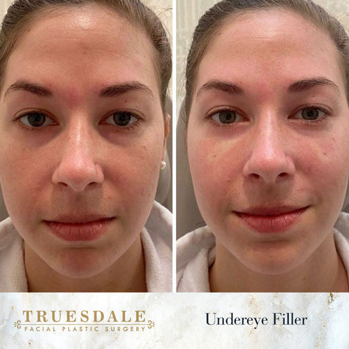 Truesdale Facial Plastic Surgery Before and After Gallery