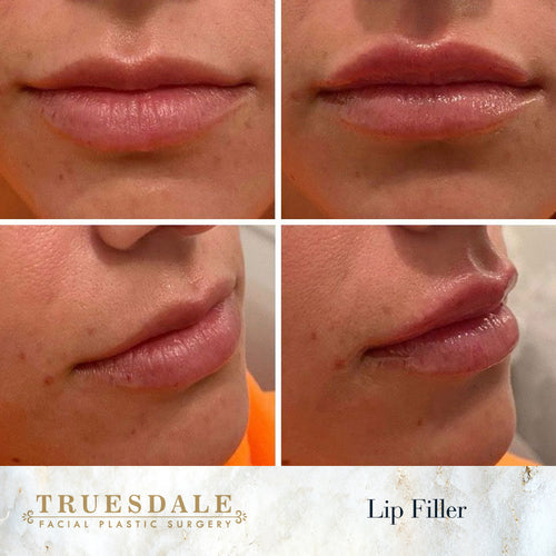 Truesdale Facial Plastic Surgery Before and After Gallery