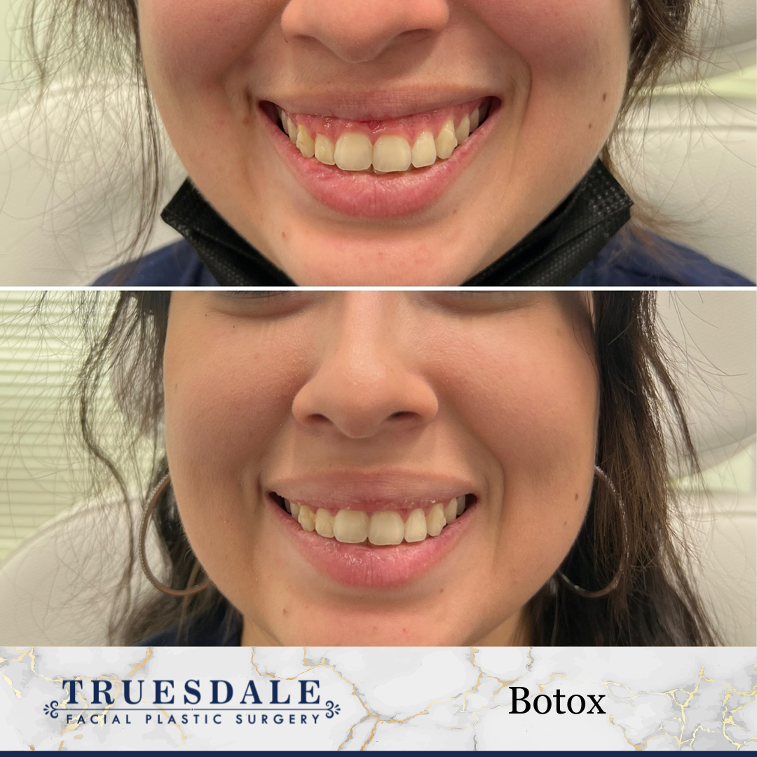 Truesdale Facial Plastic Surgery