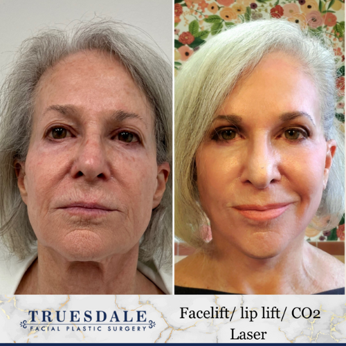 Truesdale Facial Plastic Surgery