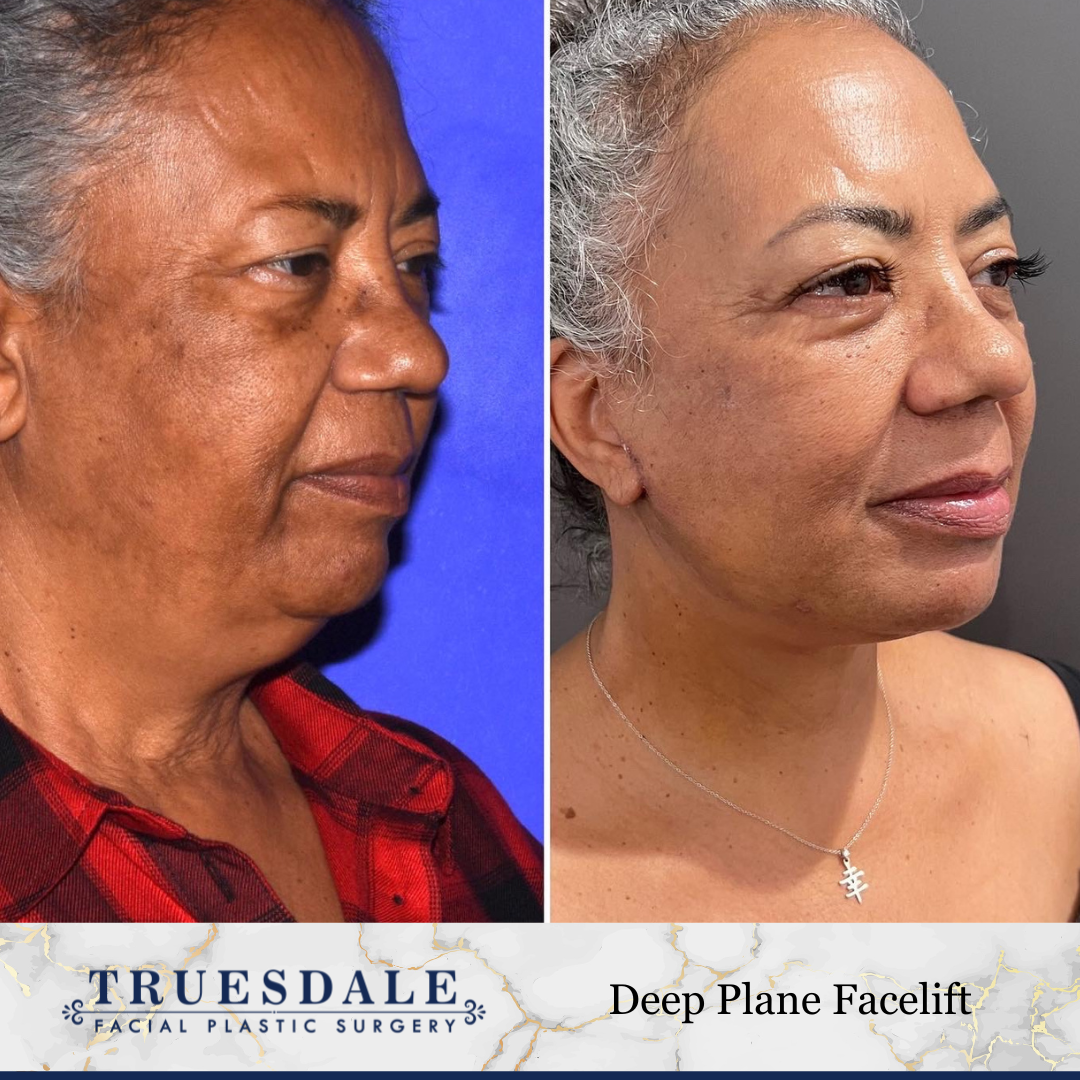 Truesdale Facial Plastic Surgery